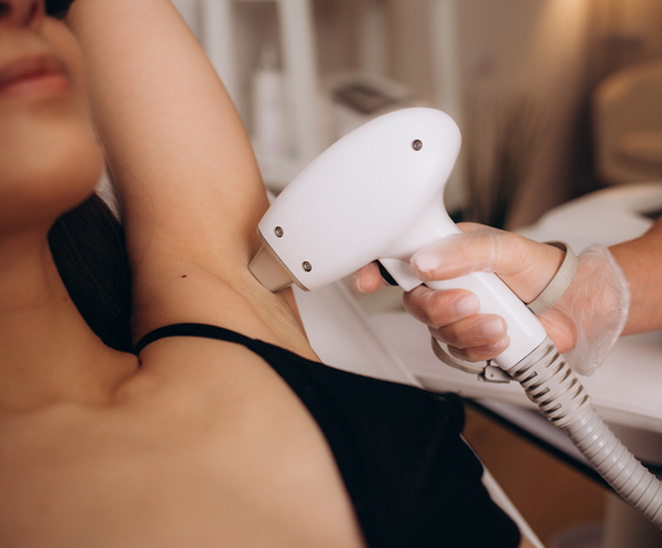 Laser Hair Removal in Birmingham, AL | Pure Esthetics - CEB-Laser1